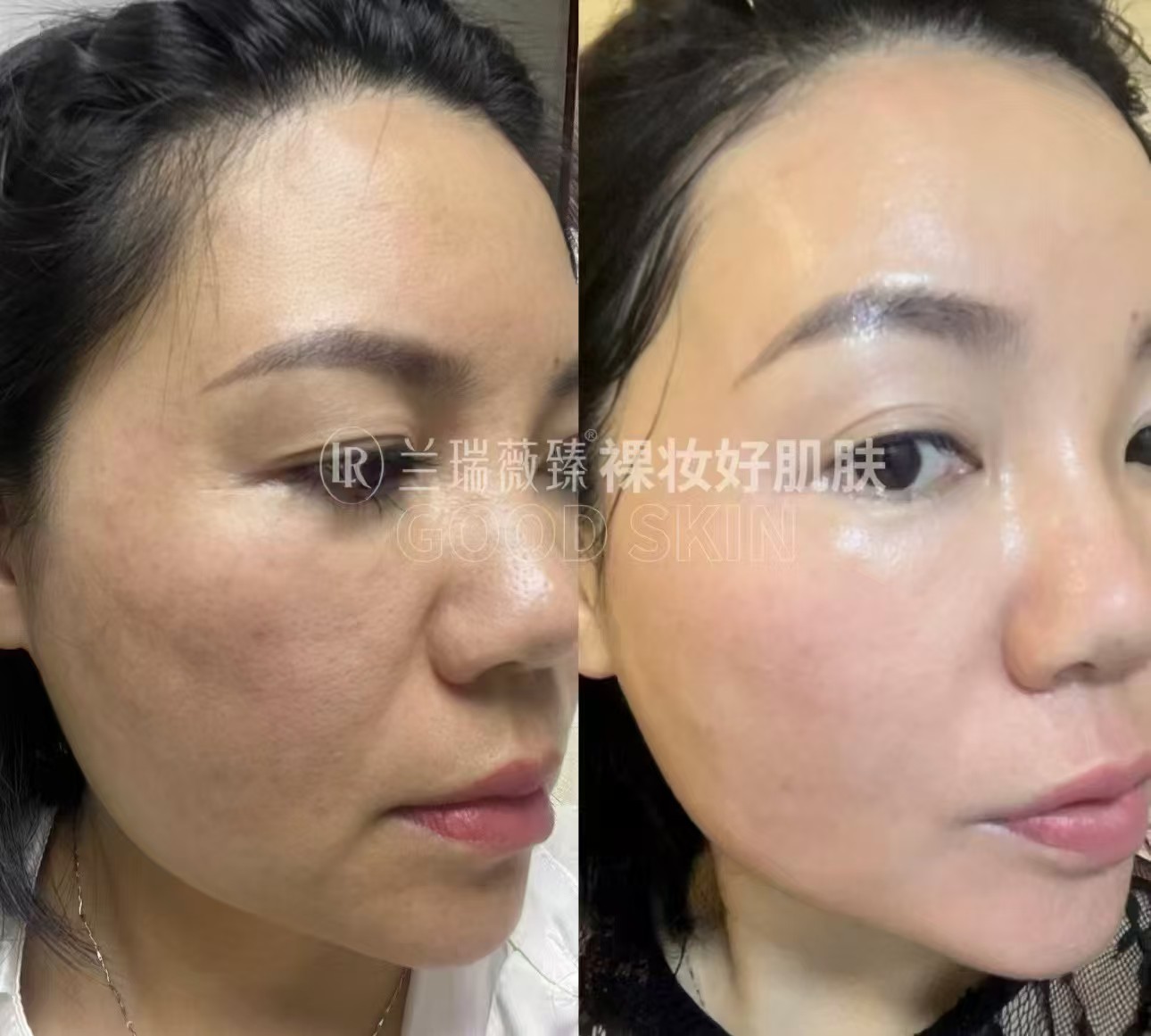 滤镜肌六件套效果图