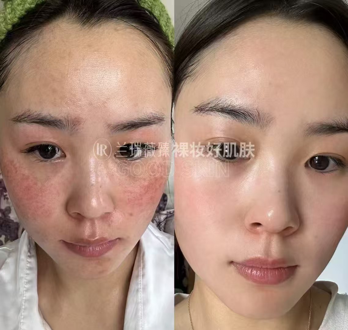 滤镜肌六件套效果图