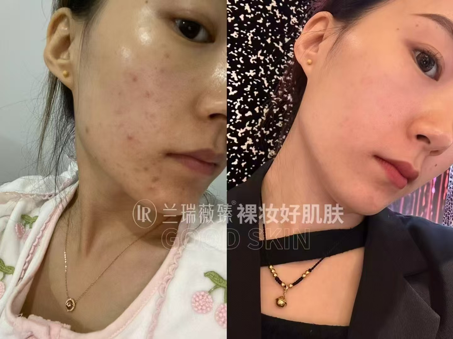 滤镜肌六件套效果图