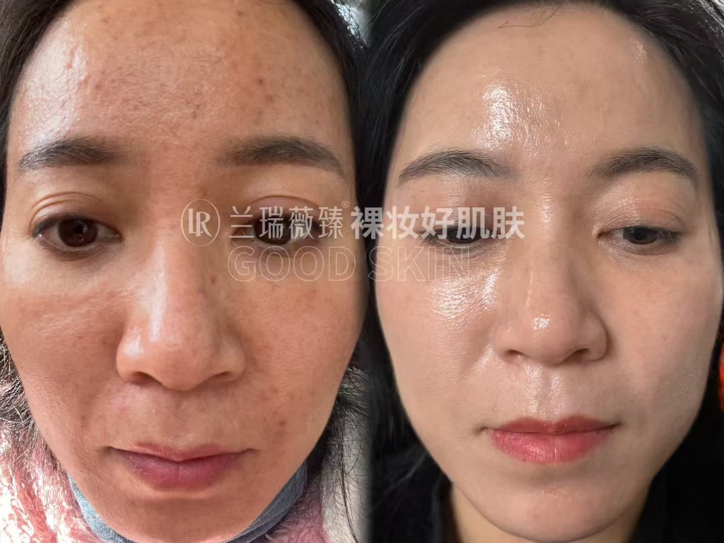 滤镜肌六件套效果图