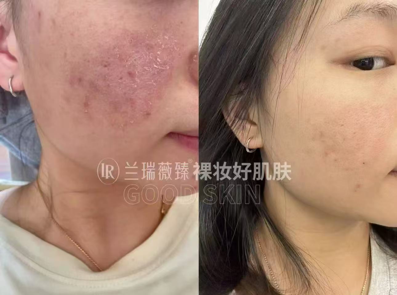 滤镜肌六件套效果图