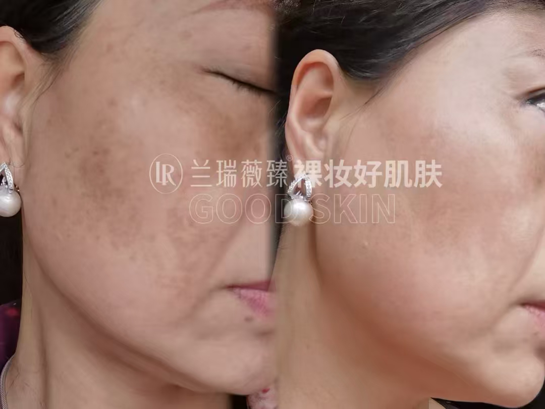 滤镜肌六件套效果图