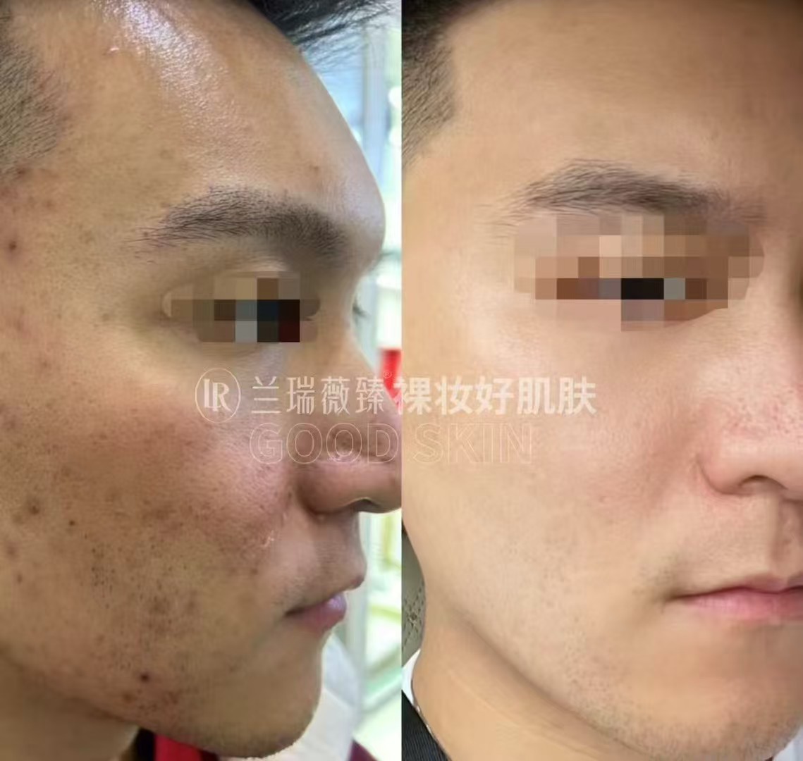 滤镜肌六件套效果图