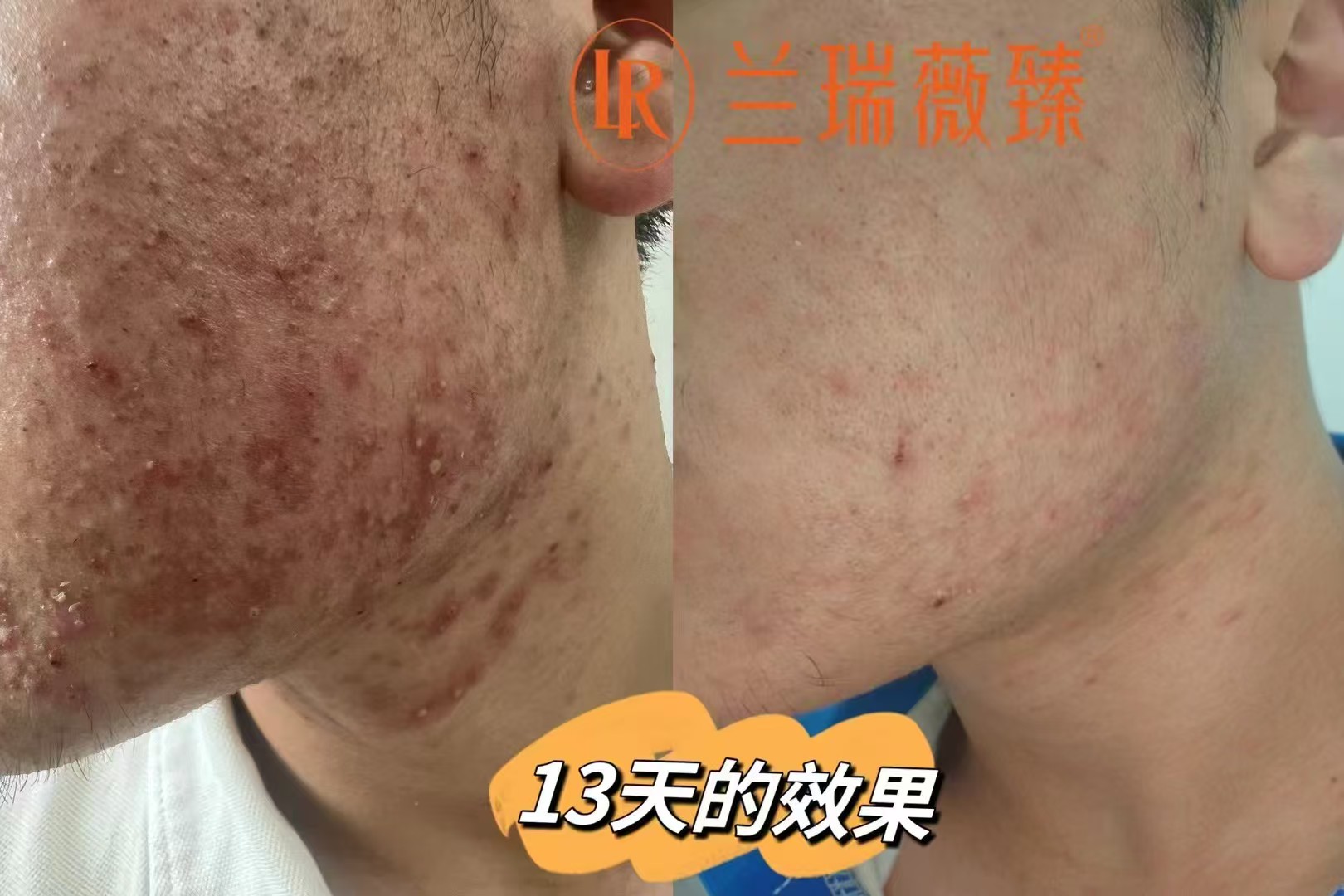 滤镜肌六件套效果图