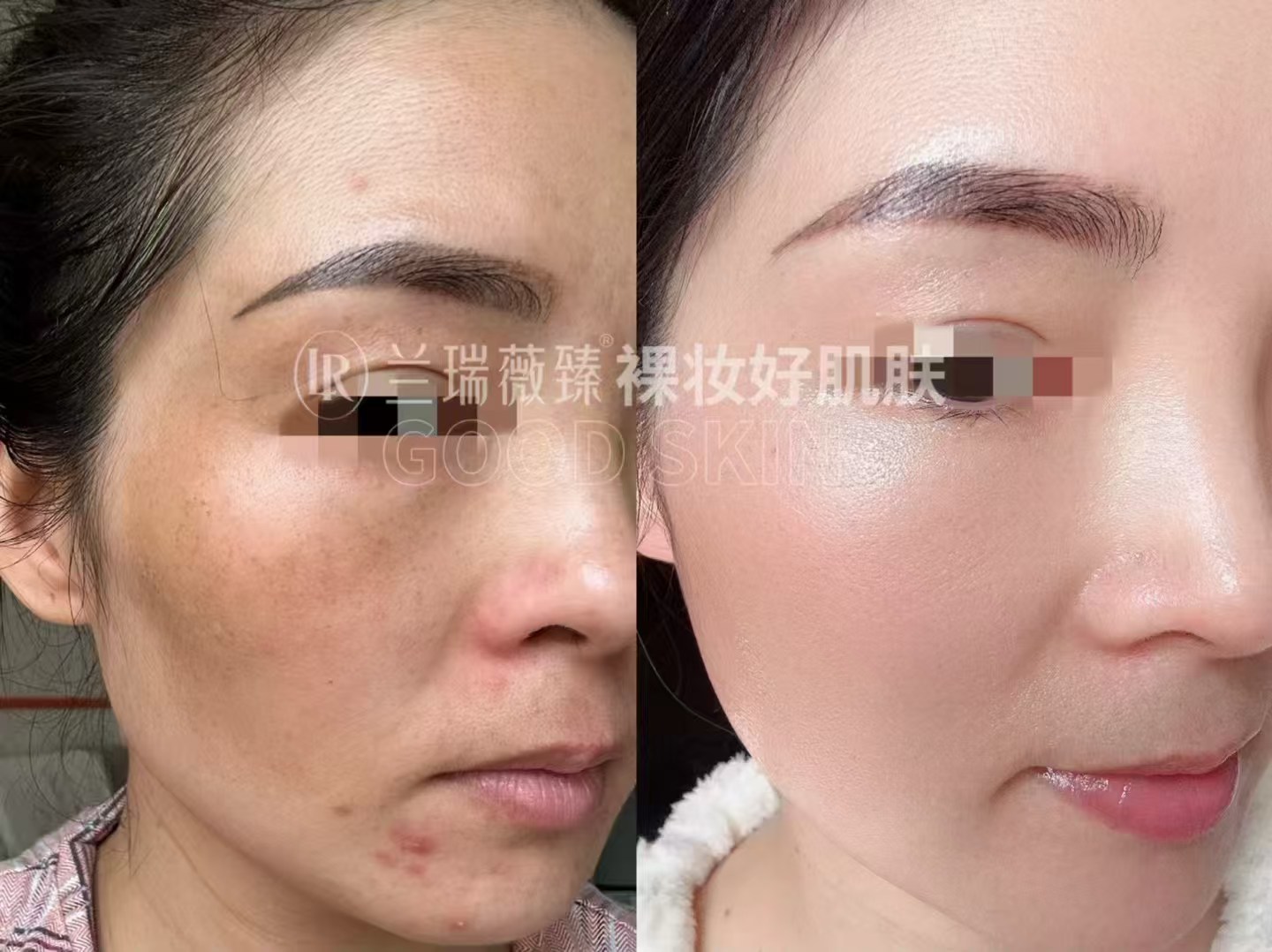 滤镜肌六件套效果图