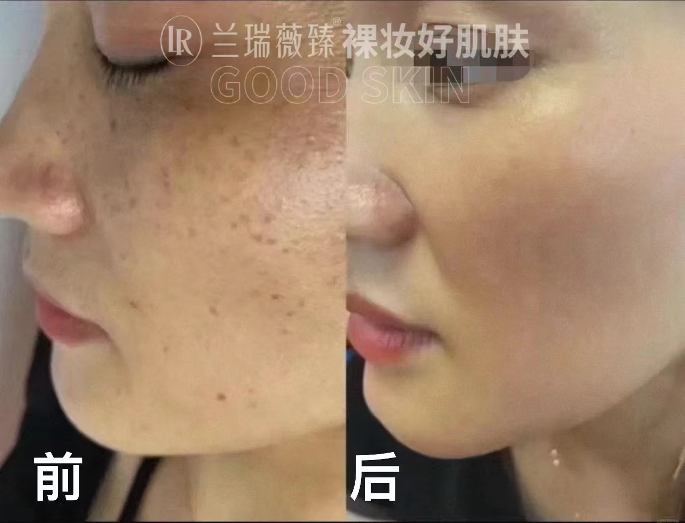 滤镜肌六件套效果图