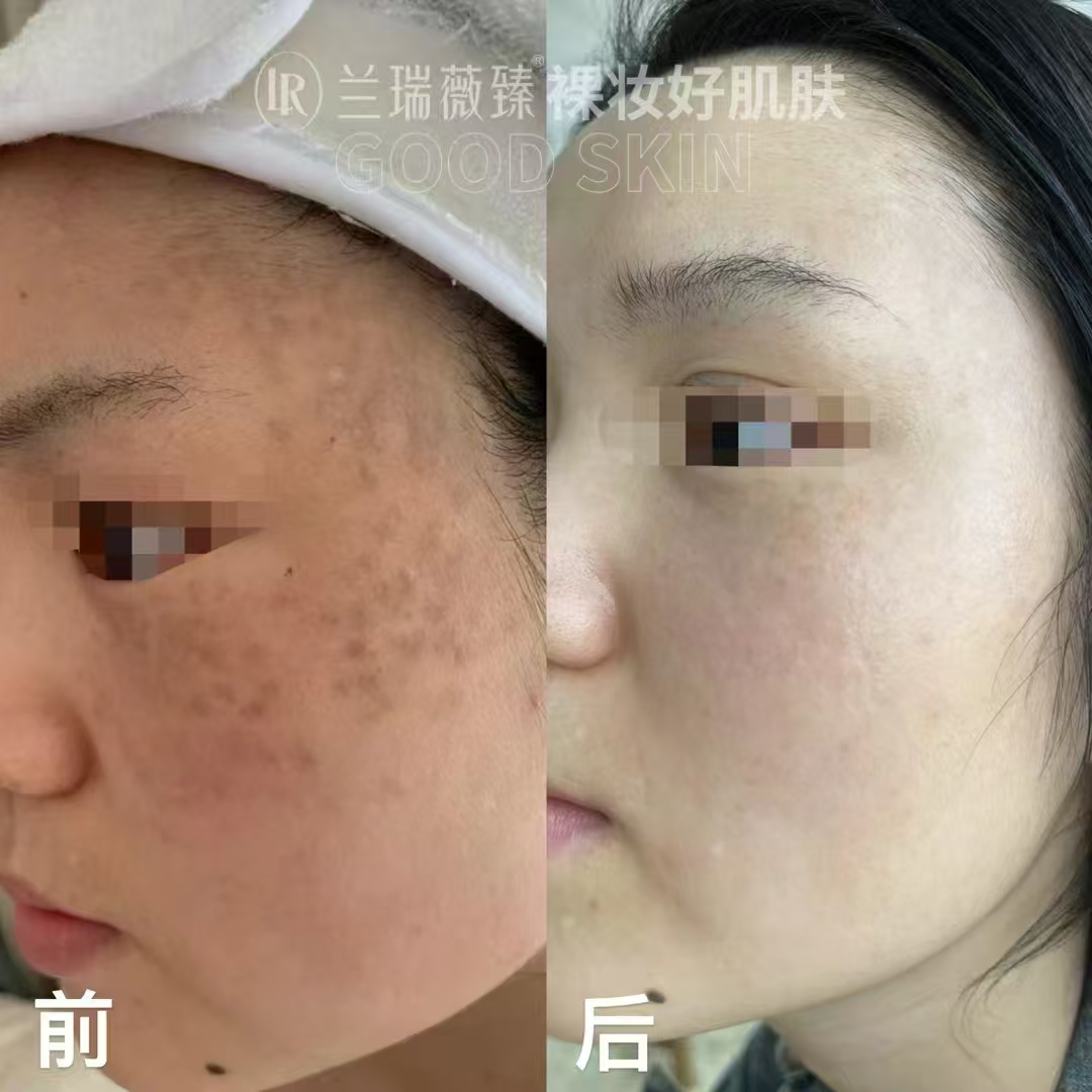 滤镜肌六件套效果图