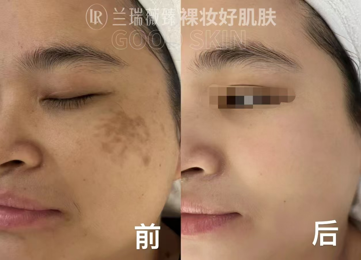 滤镜肌六件套效果图