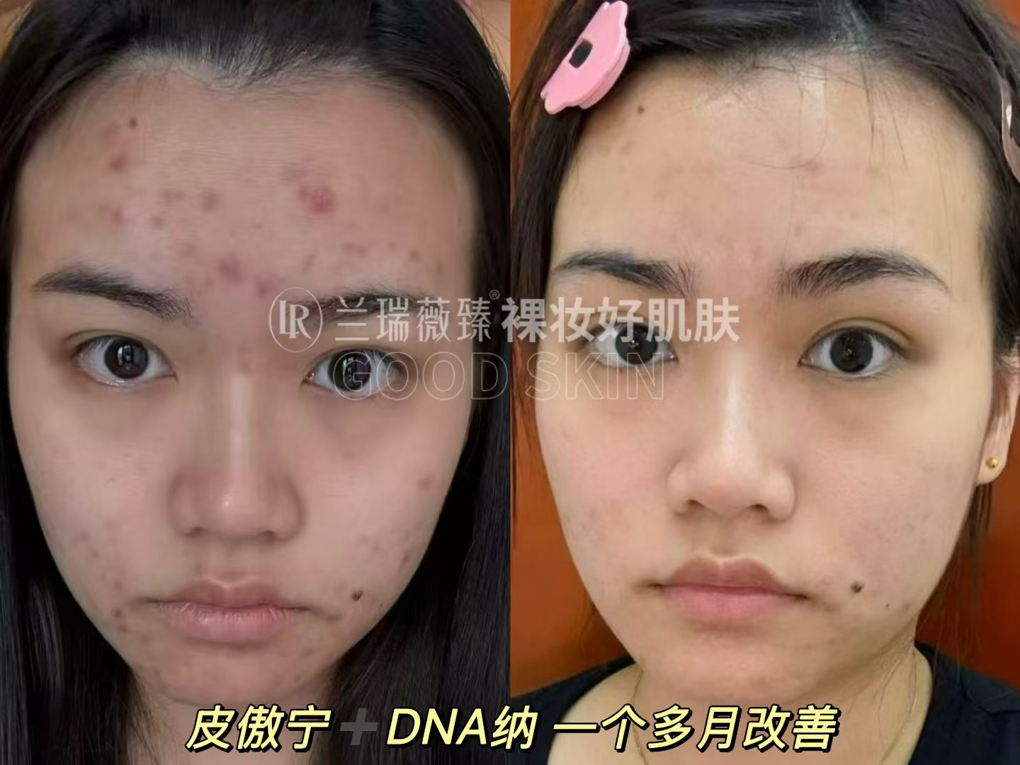 滤镜肌六件套效果图