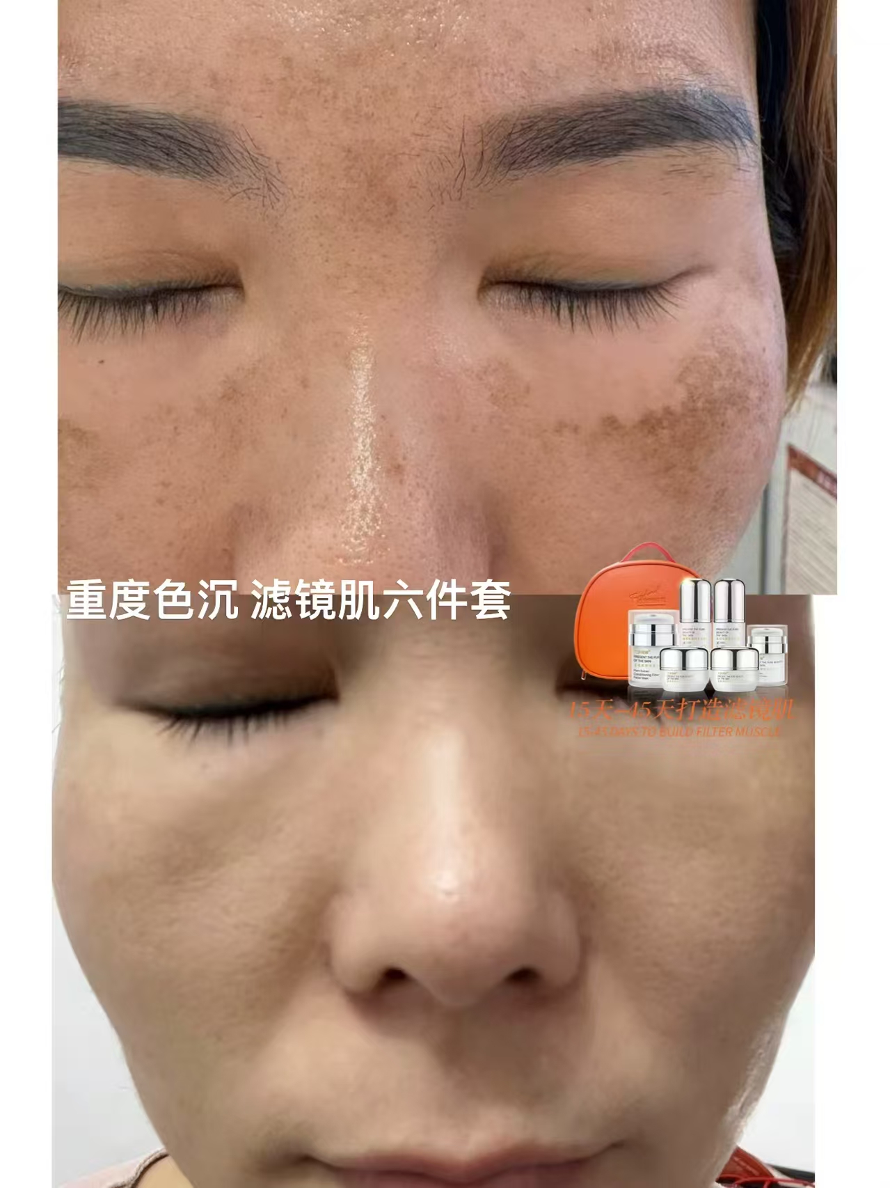 滤镜肌六件套效果图